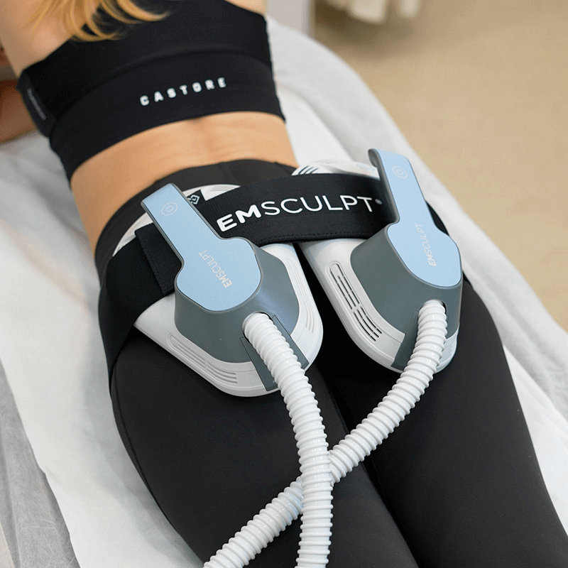 Emsculpt Treatment
