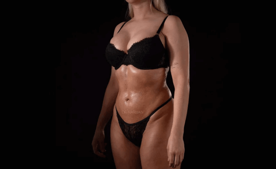 High Defination Body Contouring for Women