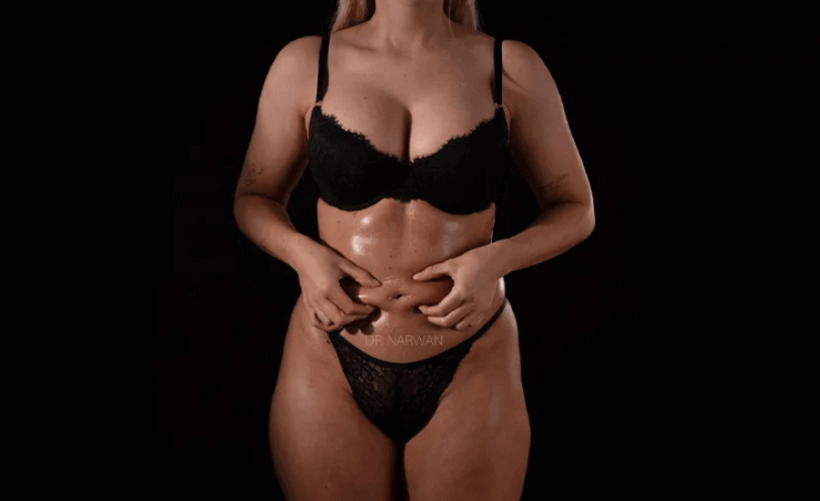 High Defination Body Contouring for Women