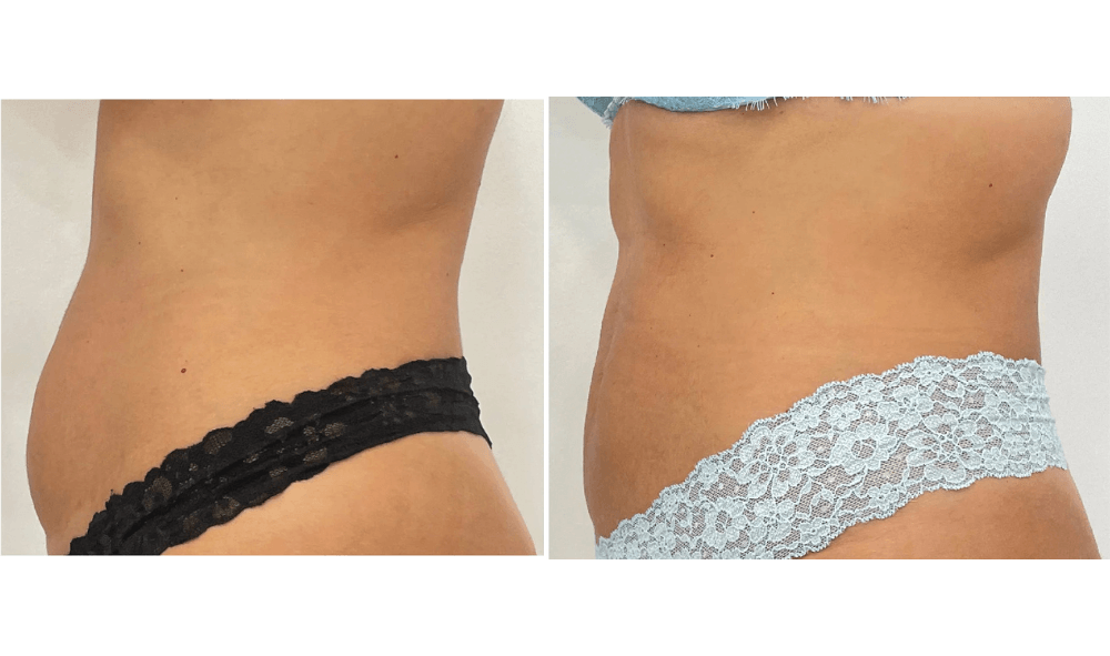 Arosha Body Wrapping